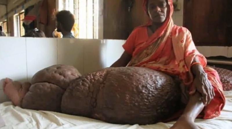 It can be fatal if the swelling spreads to the abdomen (Photo: YouTube)