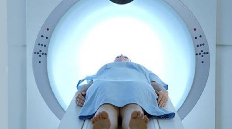 Scientists were able to show that an MRI could detect a pre-fibrotic state of the disease with a clear bright signal, as well as progressive myelofibrosis. (Representational Image)