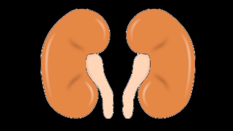 Living kidney donors more likely to develop kidney failure than non-donors, new study finds. (Photo: Pixabay)
