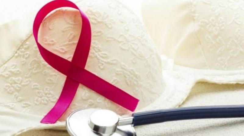 Researchers discover possible treatment for breast cancer. (Photo: AFP)