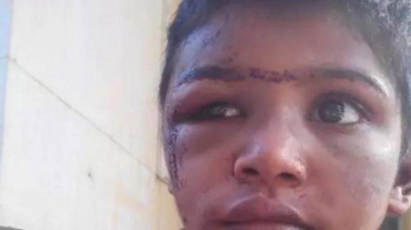 The child was allegedly tortured in confinement by her employers (Photo: Facebook)