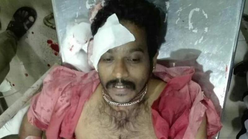 Nidesh (28), the RSS worker, was critical and he had been shifted to the Kozhikode Medical College hospital. (Photo: ANI | Twitter)