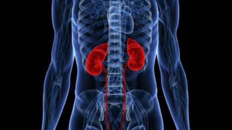 On World Kidney Day three patients battling renal problems died in Puducherry at the state-run Indira Gandhi Medical College and Research Institute.