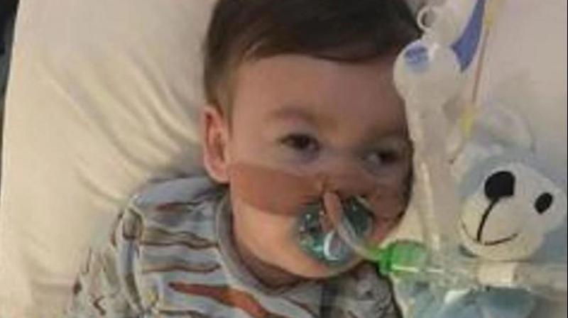 Handout picture released by Action4Alfie on April 5, 2018 shows seriously ill British toddler Alfie Evans at Alder Hey Childrens Hospital in Liverpool. (Photo: AFP)