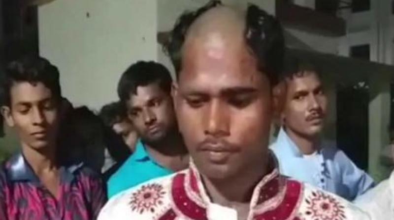 According to neighbours, the groom, his father and brother were rounded up and taken to a park nearby and tonsured. (Photo: ANI | Twitter)