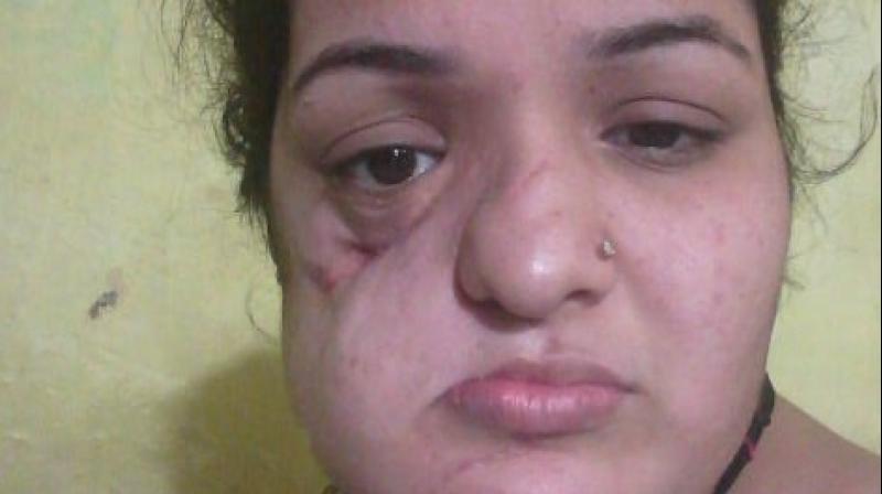 Faiza Tanveer, 25, is suffering from a recurrent ameloblastoma, an oral tumour. (Photo: Twitter | @FaizaTanveer8)