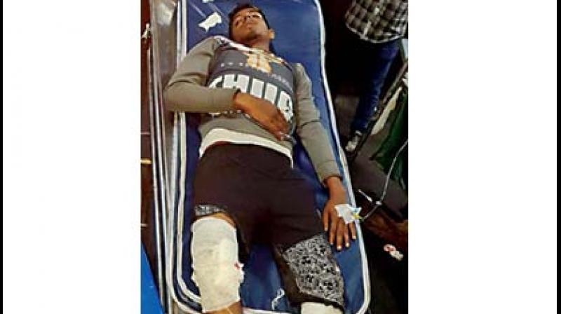 Syed Suhail being treated at Bowring hospital after he was shot in the leg by the police, on Monday. (Photo:DC)