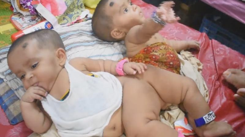 The surgery was carried out by a dozen surgeons (Photo: YouTube)