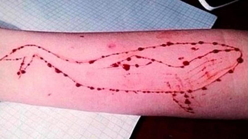 Blue Whale: A reported suicide game (Photo: Twitter)