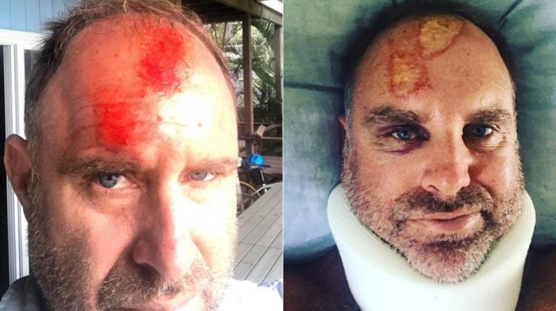 Matthew Hayden fractured his spine near the base of his neck, tore several ligaments and hurt his forehead after being dumped into a sandbank while surfing with his son Josh off North Stradbroke Island on Friday. (Photo: Instagram / Matthew Hayden)