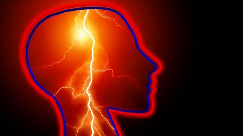 More than a third of people with epilepsy continued to have seizures despite treatment. (Photo: Pixabay)