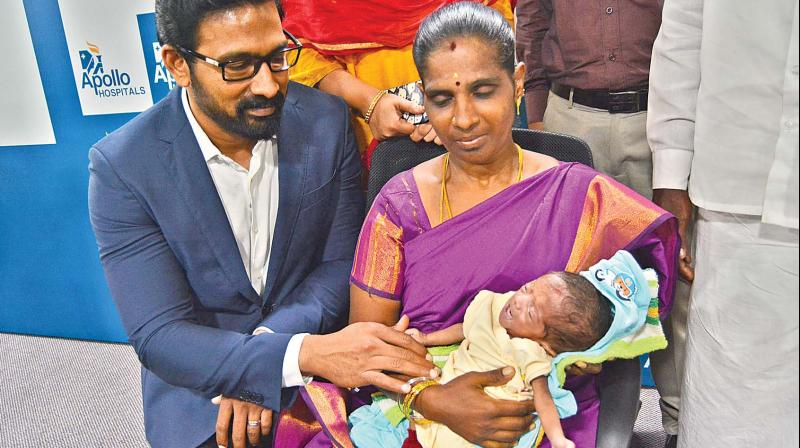 Two-week-old Revathy underwent worlds first ductal surgery at Apollo Hospitals recently in Chennai. (Photo: DC)