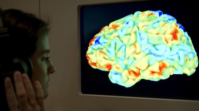 White matter is the tissue in the brain that contains axon fibers (Photo: AFP)