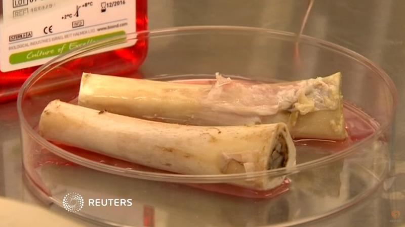 Now bones successfully grown in a lab, say Israeli firm