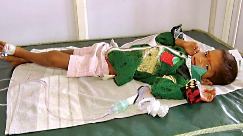 A child suffering from acute dehydration being treated at VIMS Hospital in Ballari. (Photo: DC)