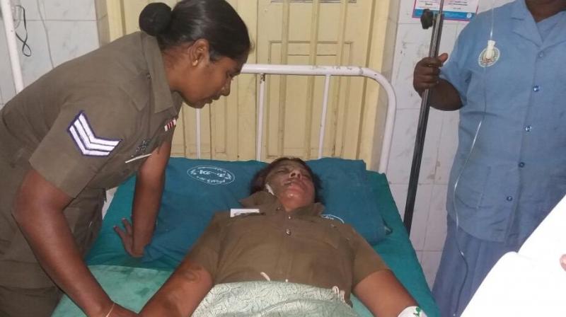 The woman constable being treated at Christian Medical College and Hospital