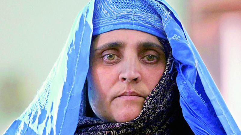 Gula, popularly known as the Afghan girl, is reportedly suffering from Hepatitis C besides having some other health issues.