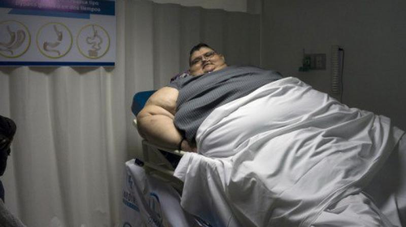 In the first procedure, surgeons will remove more than three-quarters of the patients stomach (Photo: AFP)
