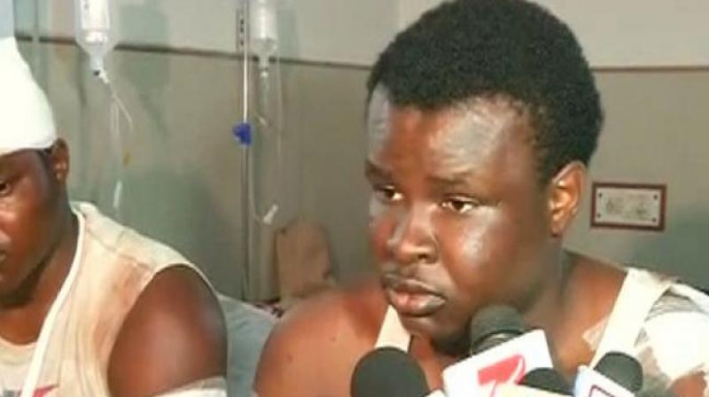 A Nigerian national who was assualted by a mob last Monday. (Photo: ANI)