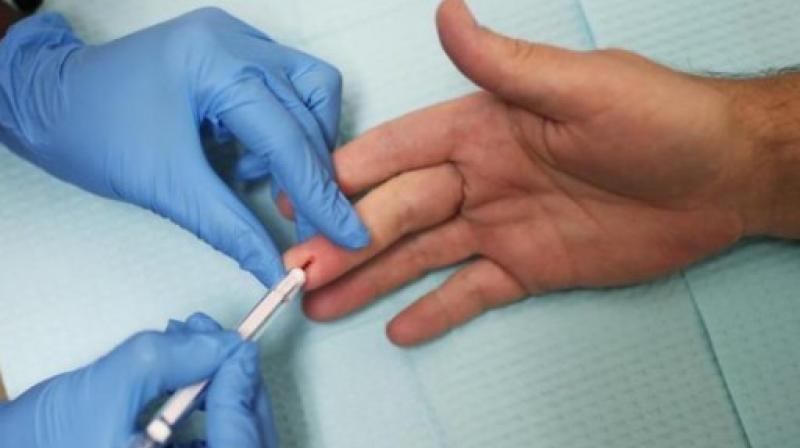 Twenty-three countries currently have national regulations that support HIV self-testing (Photo: AFP)