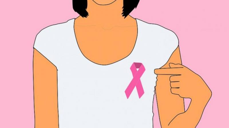 Misconceptions lead women to avoid breast cancer radiation therapy. (Photo: Pixabay)