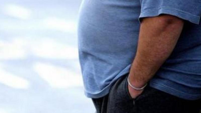 The obesity noted is usually in the truncal and abdomen region.   (Representational Image)