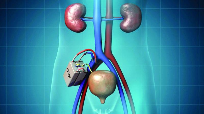 1.5L  People are in waiting lists for kidney transplants according to estimates drawn by the ministry of health and family welfare.