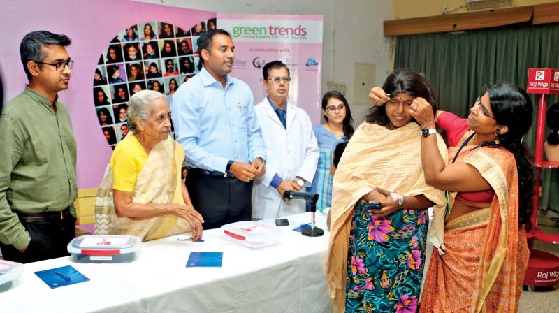 A Cancer victim wears a wig donated by members of Tangled 2017 at a hair donation drive at Adyar Cancer Institute on Wednesday. (Photo: DC)