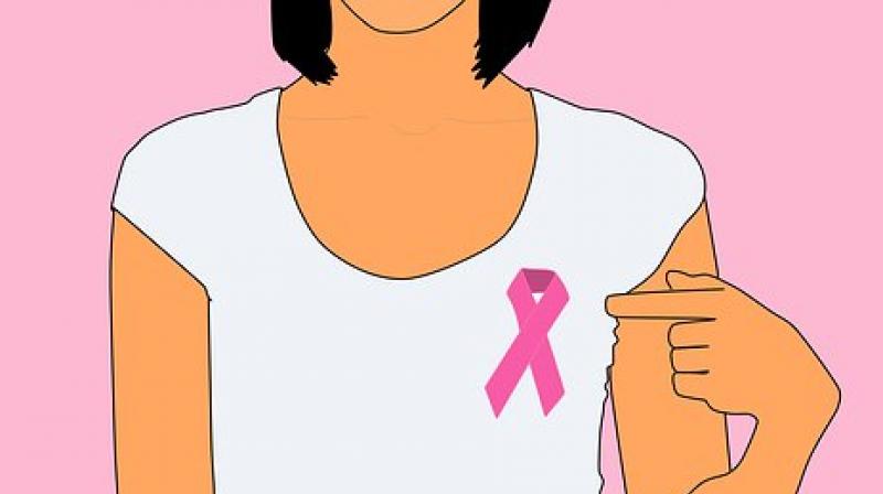 A newly designed three-part molecule could be the one answer patients with a certain form of breast cancer. (Photo: Pixabay)