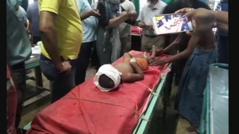 The child is admitted to Malda Medical College and Hospital where he is undergoing treatment. (Photo: Twitter | ANI)