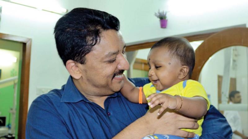 Dr S.M. Balaji with a young cleft lip patient. (Photo: DC)