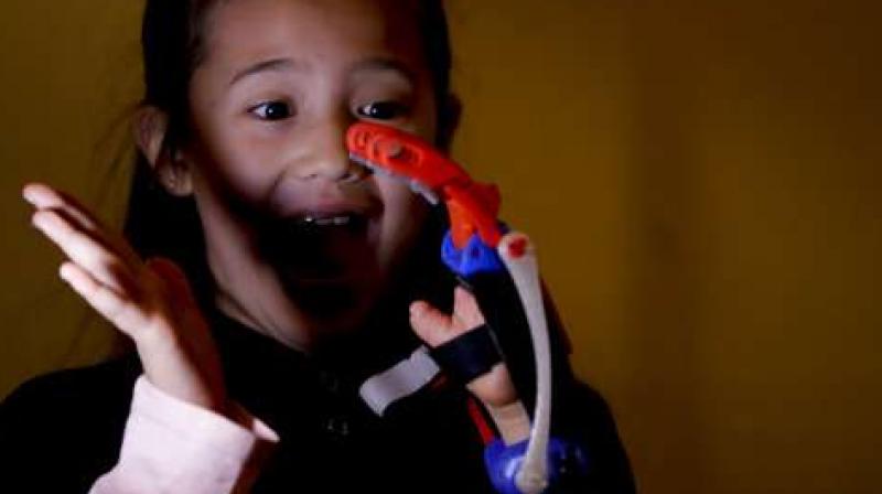 In this June 12, 2017 photo, Kaori Misue breaks into a smile in Buenos Aires, Argentina. Misue has a brand new prosthetic hand thanks to the genius of 21-year-old inventor Gino Tubaro and his 3D printer. Today, more than 500 people, mostly children, have received similar prostheses and 4,500 more remain on a waiting list. (AP Photo/Natacha Pisarenko).