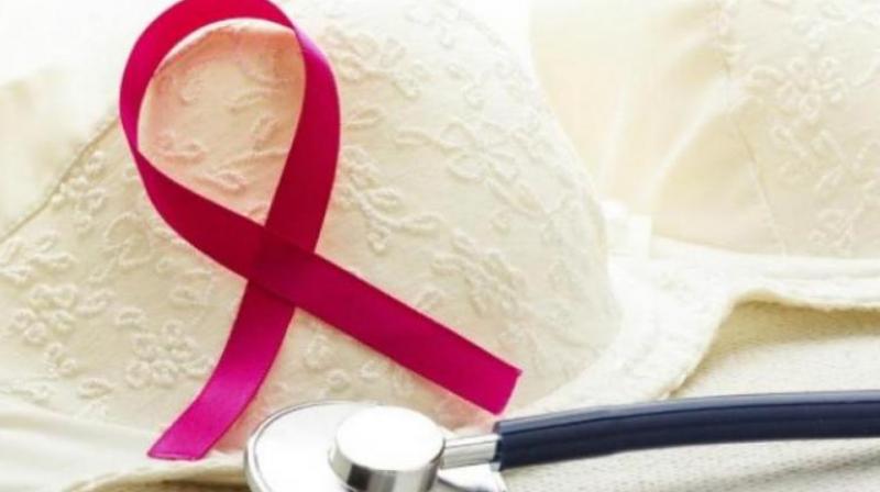Fertility preservation in breast cancer patients. (Photo: AFP)