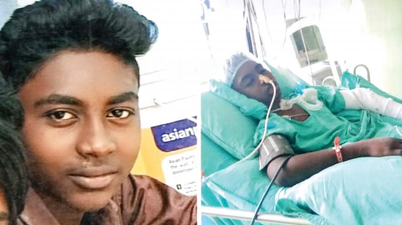 Abi before surgery(left); and at a private hospital in Thiruvananthapuram(right).