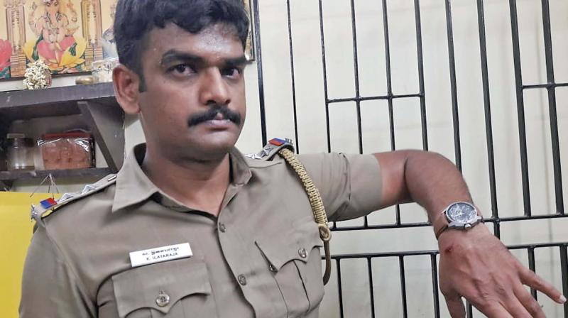 The incident happened when a team of Mylapore law and order police went to Palla Kumar Nagar near Mylapore railway station to catch history-sheeter Dokkan Raja (45).