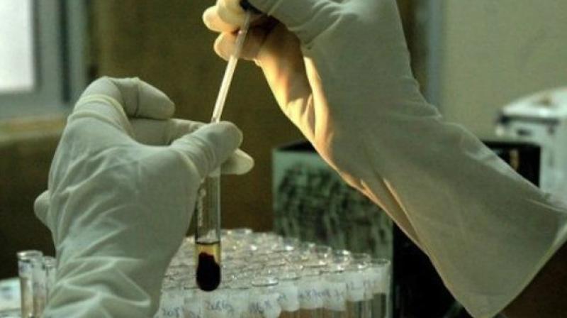 Director General of the Council of Scientific and Industrial Research Dr Girish Sahni on Saturday said that an Innovation Fund of Rs 400 crore would be set up for helping scientific research done in its labs reach the public through industry. (Representational image)
