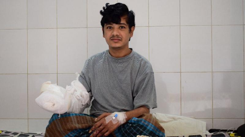 Bangladeshi man Abul Bajandar, widely known as Tree Man for his rare disease, has had 16 surgeries to remove the warts covering his body. (Photo: AFP)