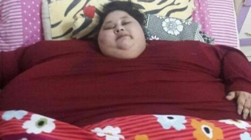 Eman weighed around 500 kg when she was brought to Mumbais Saifee Hospital. (Photo: AFP)