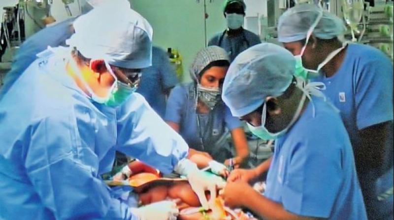 The procedure was successfully completed on the patient, said Dr. T.S. Chandrasekar,  gastroenterologist and chairman, Medindia Hospitals. (Representational Image)
