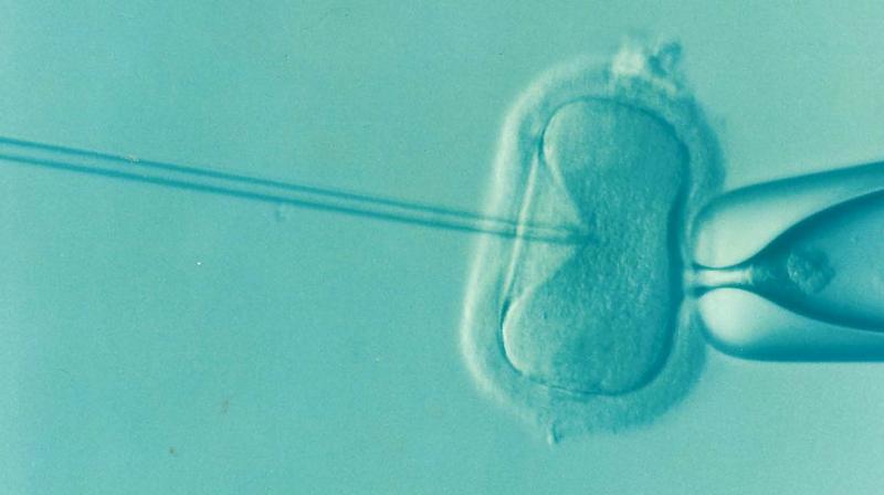 Researchers find kissing hormone could reduce life-threatening IVF complications