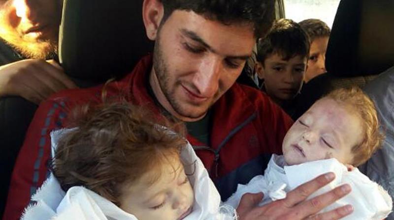 Abdel Hameed Alyousef lost his two children, his wife and other relatives in the suspected chemical attack (Photo: AP)