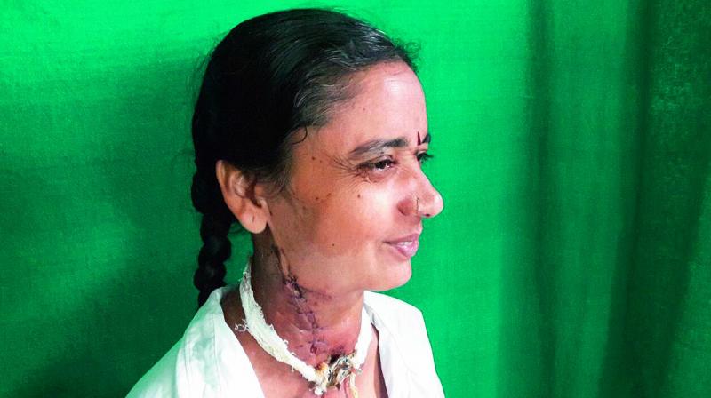 R. Latha who underwent the surgery.