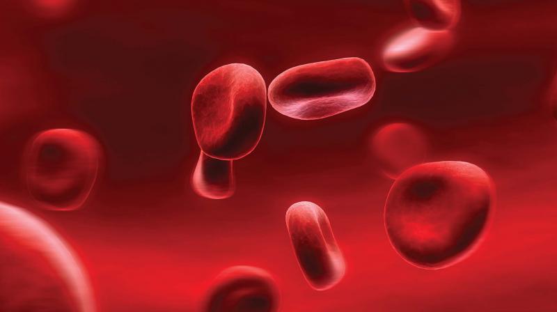 People with hemophilia bleed easily, and the blood takes a longer time to clot.