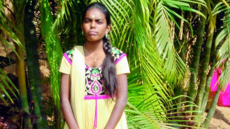 She burnt herself at her residence in Sangareddy and succumbed to her injuries on Monday.