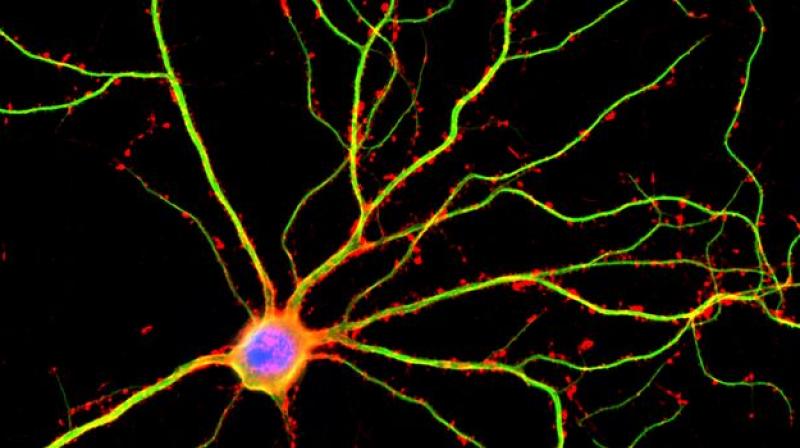 UCLA scientists discovered that dendrites (shown here in green) are not just passive conduits for electrical currents between neurons. (Image: UCLA)