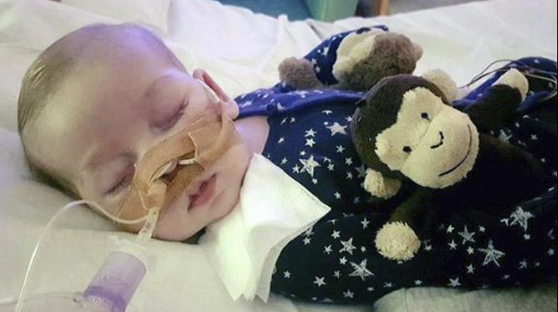 A 11-month old baby Charlie Gard at Great Ormond Street Hospital in London. Gard died of a rare genetic condition (Photo: AP)