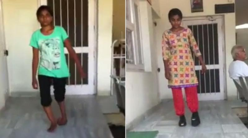 The doctor who performed the surgery on Rajwant Kaur named it Octoplus Club foot due to the foots resemblance to the animal.(Photo: Youtube)