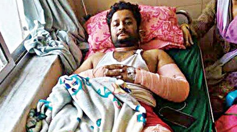 Vivek Shetty, who was allegedly assaulted by Kagwad  MLA Raju Kages supporters in Belagavi
