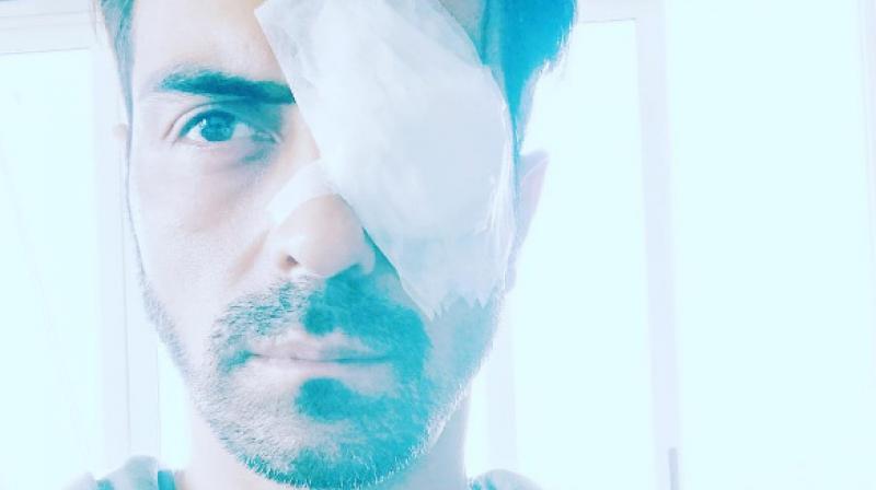 Arjun Rampal injures himself, resting with a bandaged eye