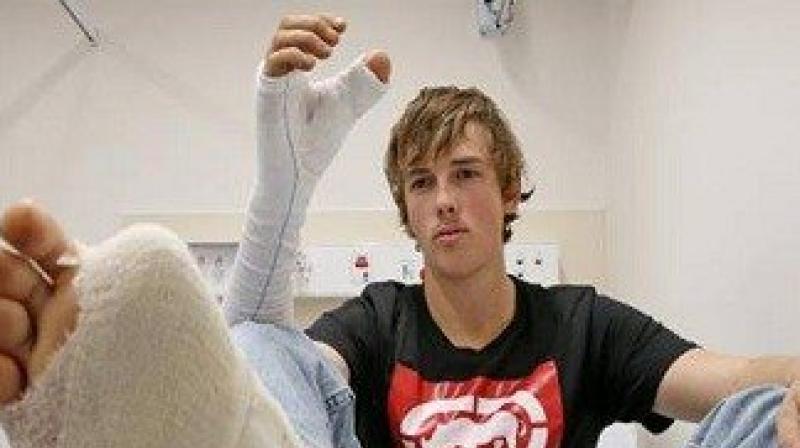 An Australian cattle worker whose thumb was severed by a bull has had his toe surgically transplanted in its position. (Photo: Twiter/@ejovip1)